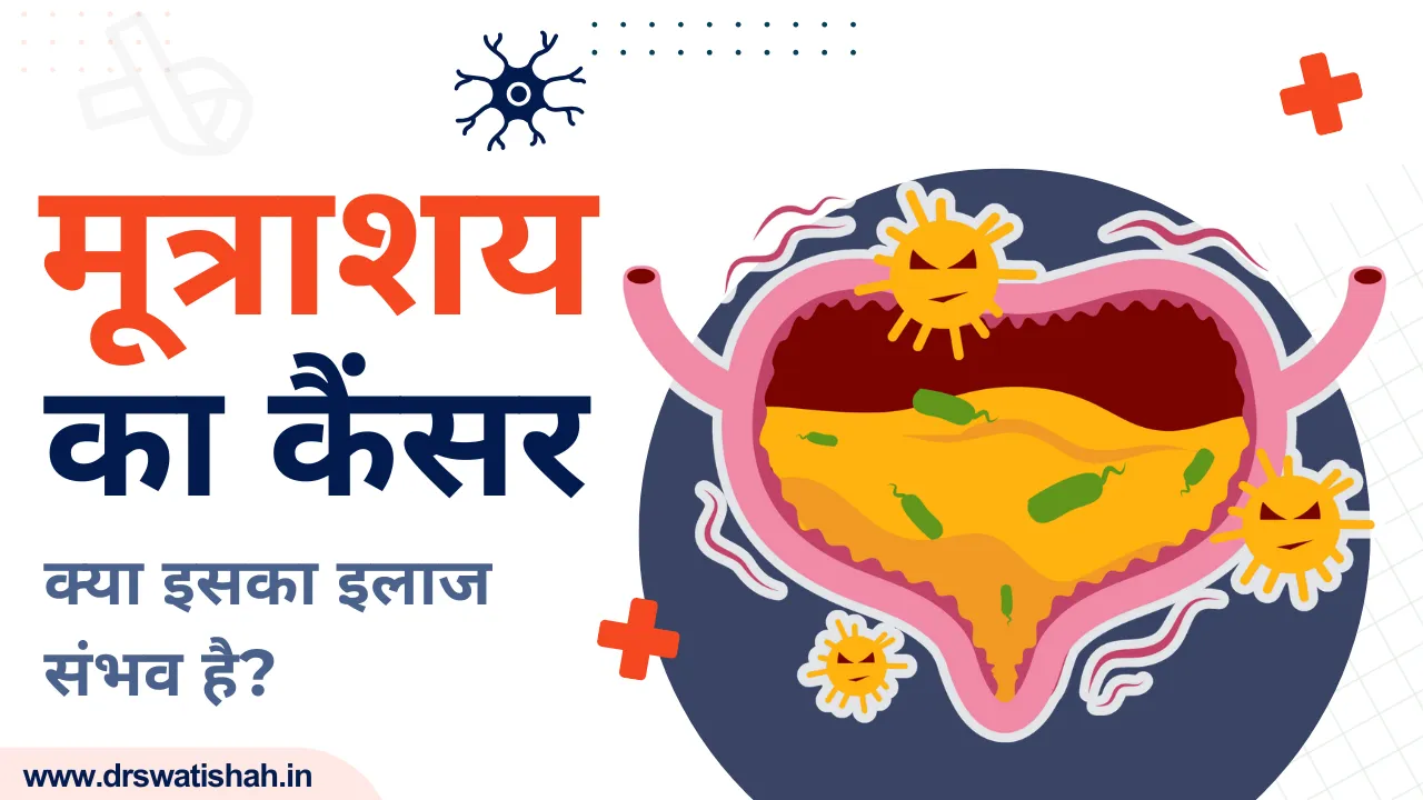 मूत्राशय कैंसर