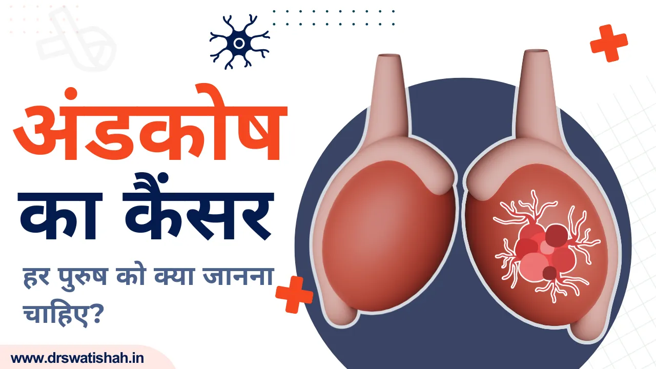 वृषण का कैंसर
