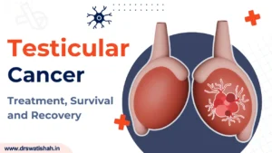 Testicular Cancer