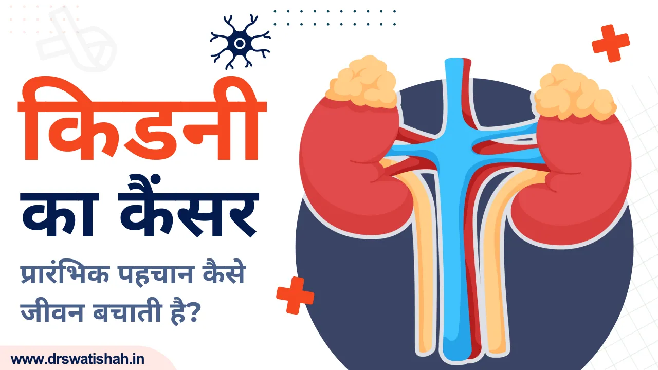 किडनी का कैंसर: प्रारंभिक पहचान कैसे जीवन बचाती है।