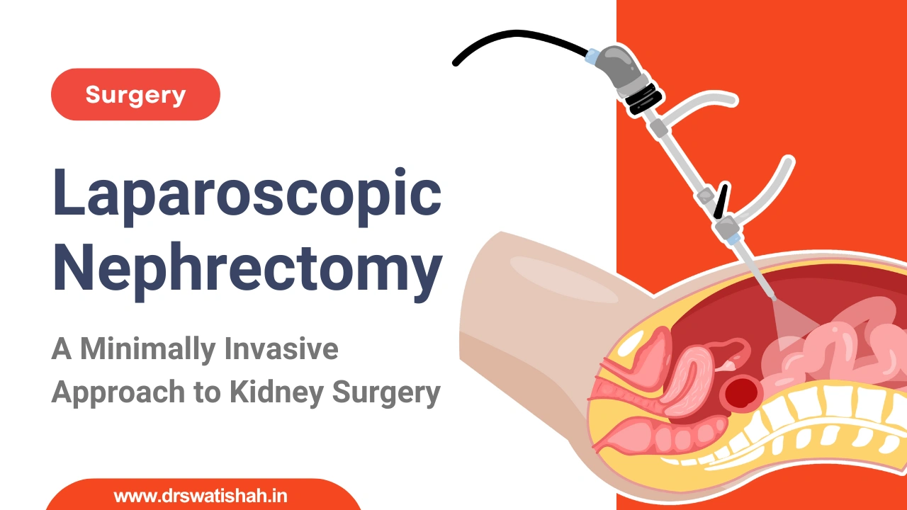 Laparoscopic Nephrectomy: A Minimally Invasive Kidney Surgery