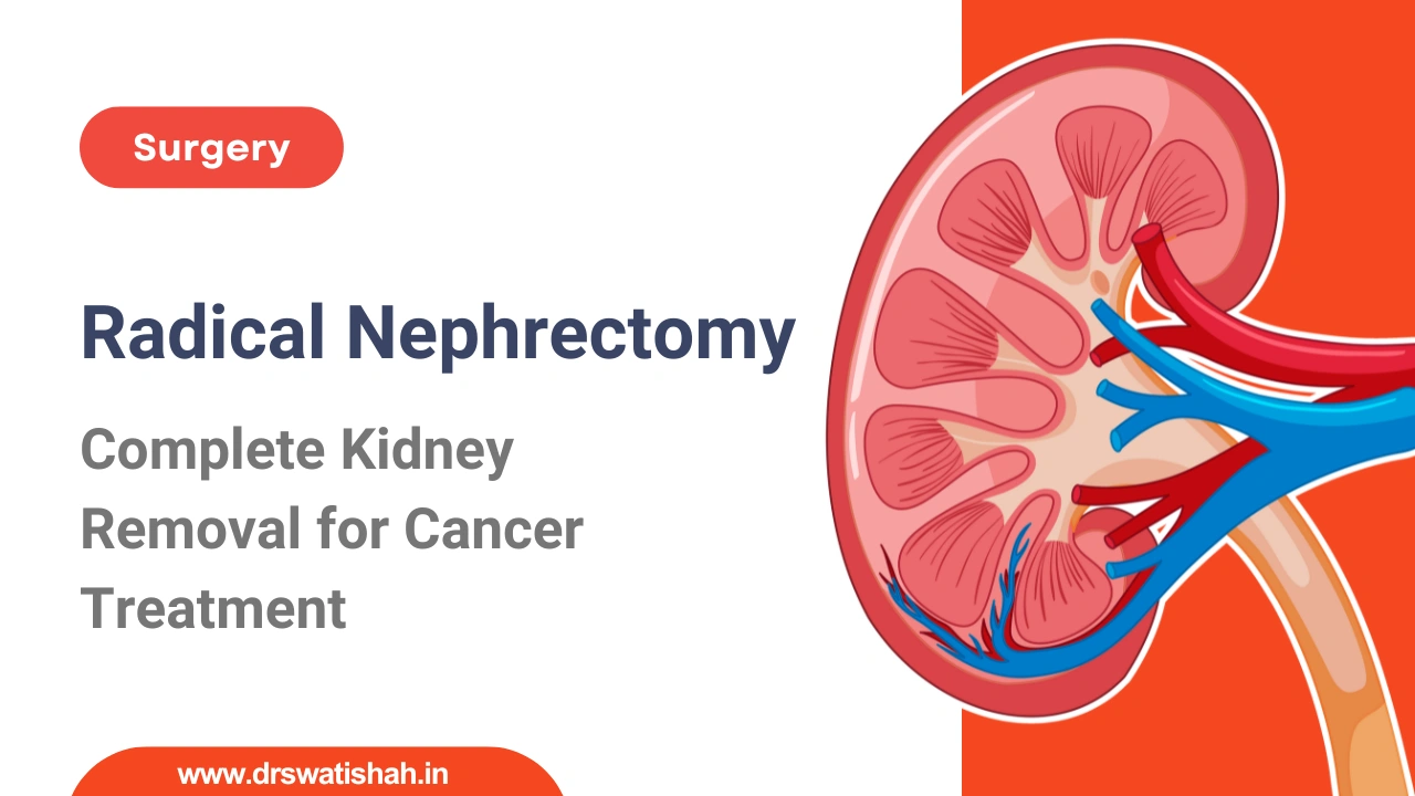 Radical Nephrectomy Surgery: Benefits, Risks & Recovery