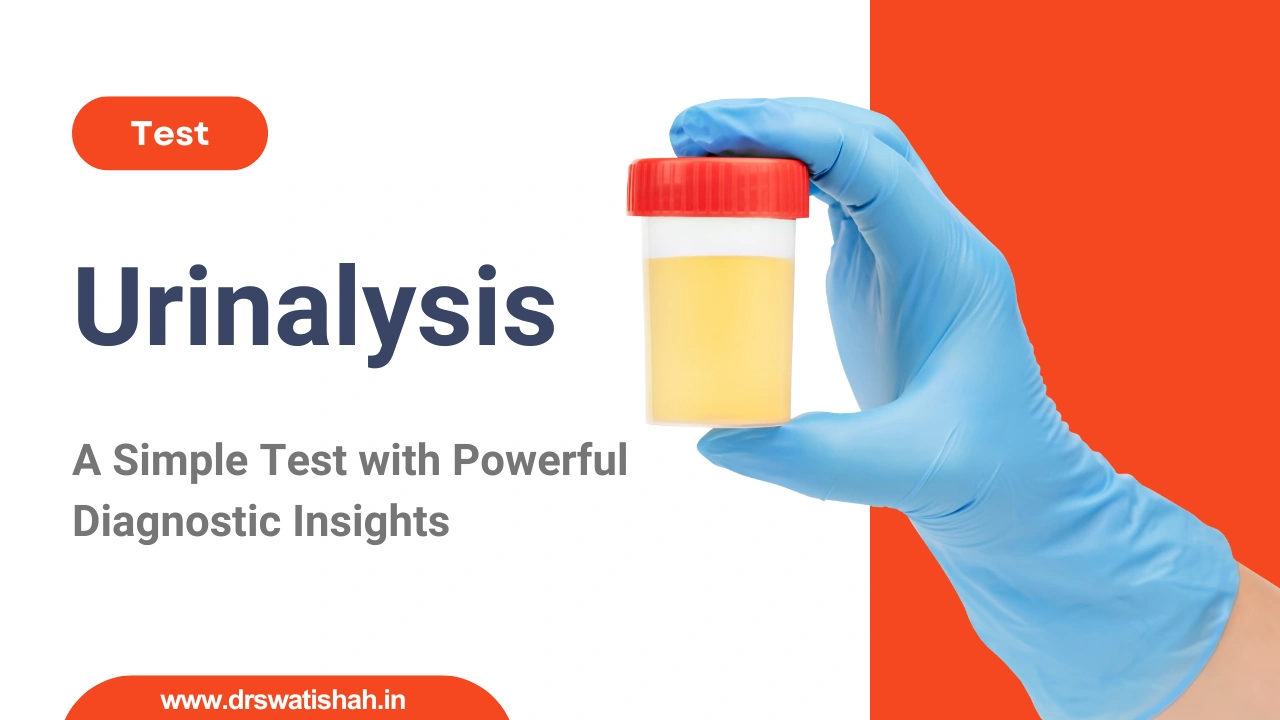 Urinalysis: Uses, Types, Procedure & Results