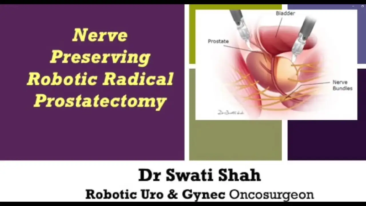 Nerve Preserving Robotic Radical Prostatectomy