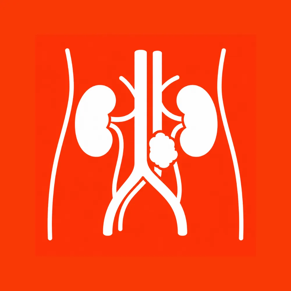 Retroperitoneal Cancer