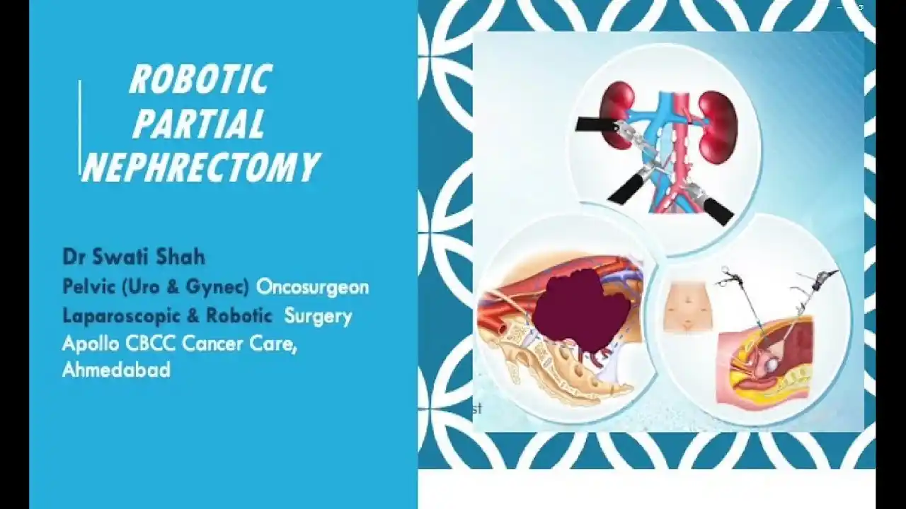 Robotic Partial Nephrectomy