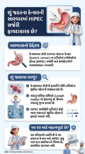 જઠરના કેન્સરની સારવારમાં HIPEC સર્જરી કેટલી અસરકારક છે-સ્ત્રોત 10.1245s10434-025-18743-2