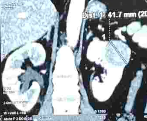 1 2